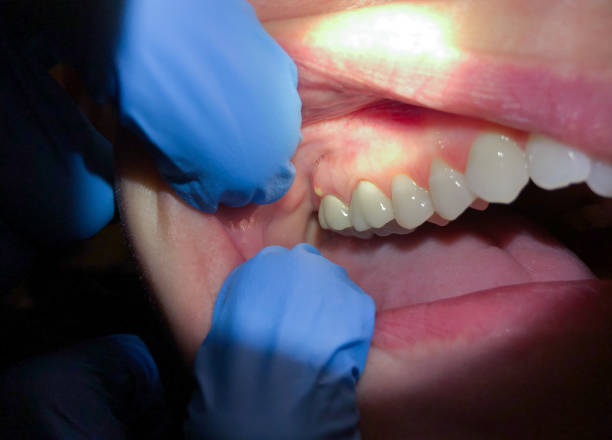 Best Emergency Orthodontic Repairs in Cienegas Terrace, TX