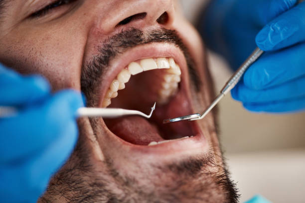 Best Walk-In Emergency Dentist in Cienegas Terrace, TX